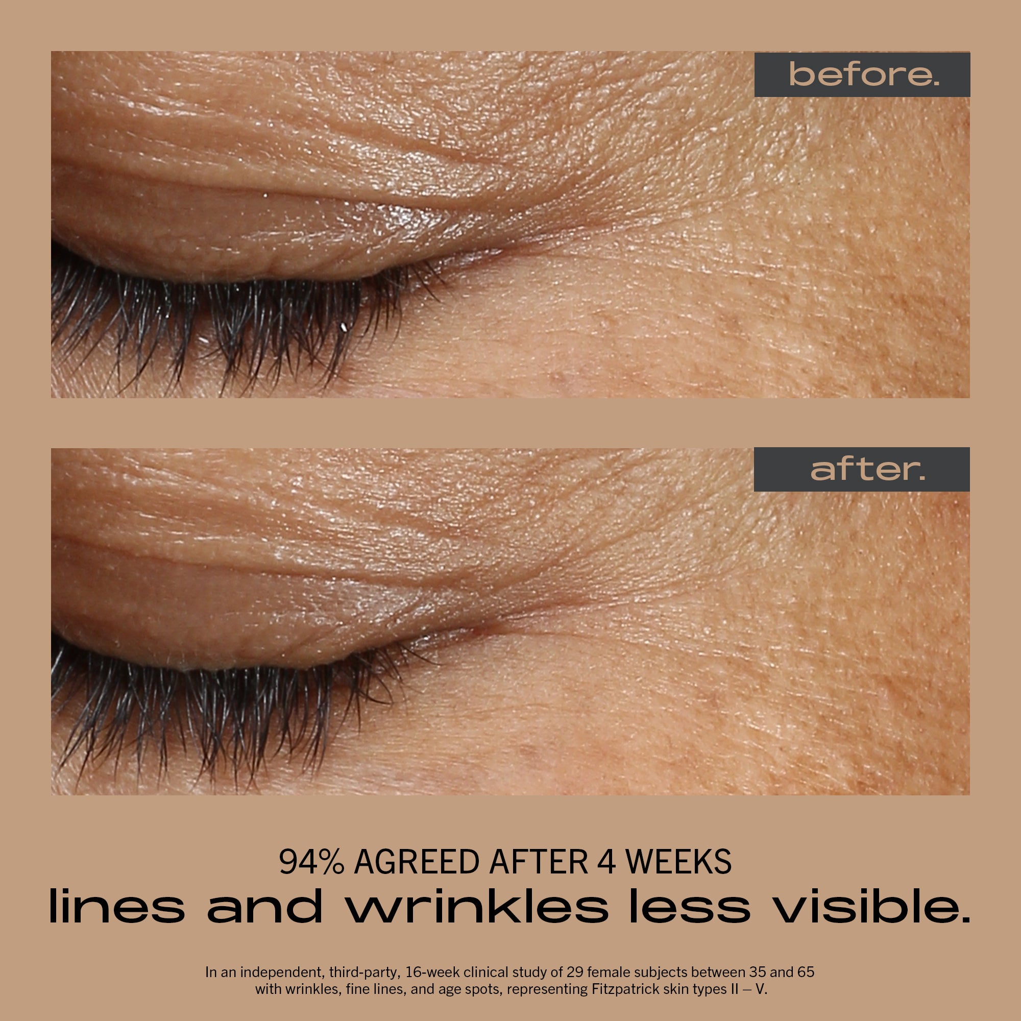 Wrinkle + Texture Concentrate - 30mL